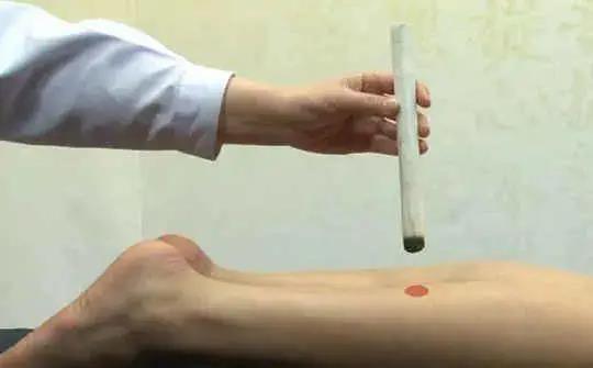 人體“消毒穴”每周艾灸4次，逼出陳年藥毒！