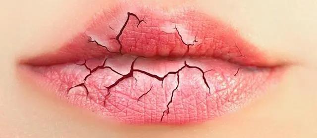嘴唇干裂，或許不是缺水，嘴唇老是干艾灸什么穴位！