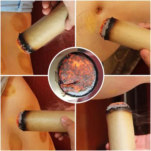 灸溫，到底是燙的好還是溫的好？為什么有的人感覺(jué)不到熱?