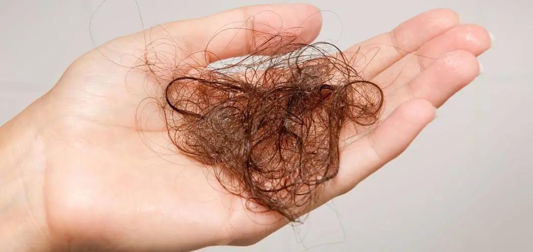 你脫的不是發(fā)，是氣血！艾灸拯救脫發(fā)危機！